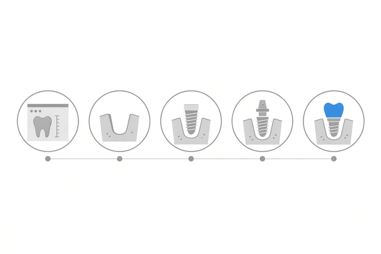 Professional header image for step-by-step guide: Zobni implantat: koliko časa traja postopek od prvega pre...